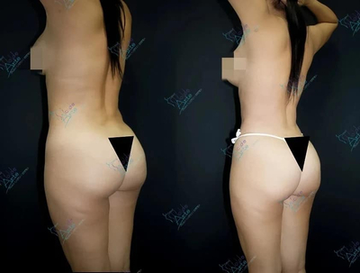 Slider image (1) Dr. Fernando Munar - Plastic Surgery